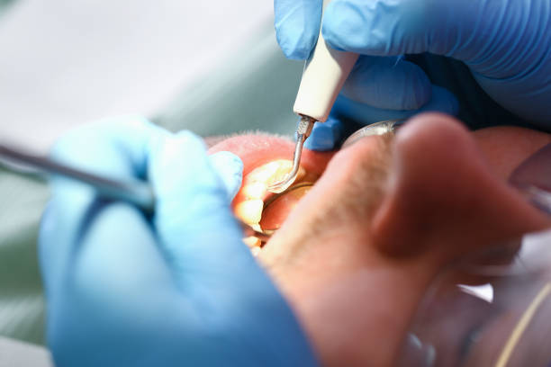 Best Pediatric Emergency Dentist in Fort Meade, FL