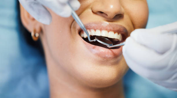 Best Emergency Gum Treatment in Fort Meade, FL